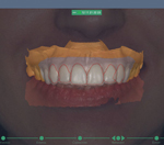 SmileDesignSoftware-r