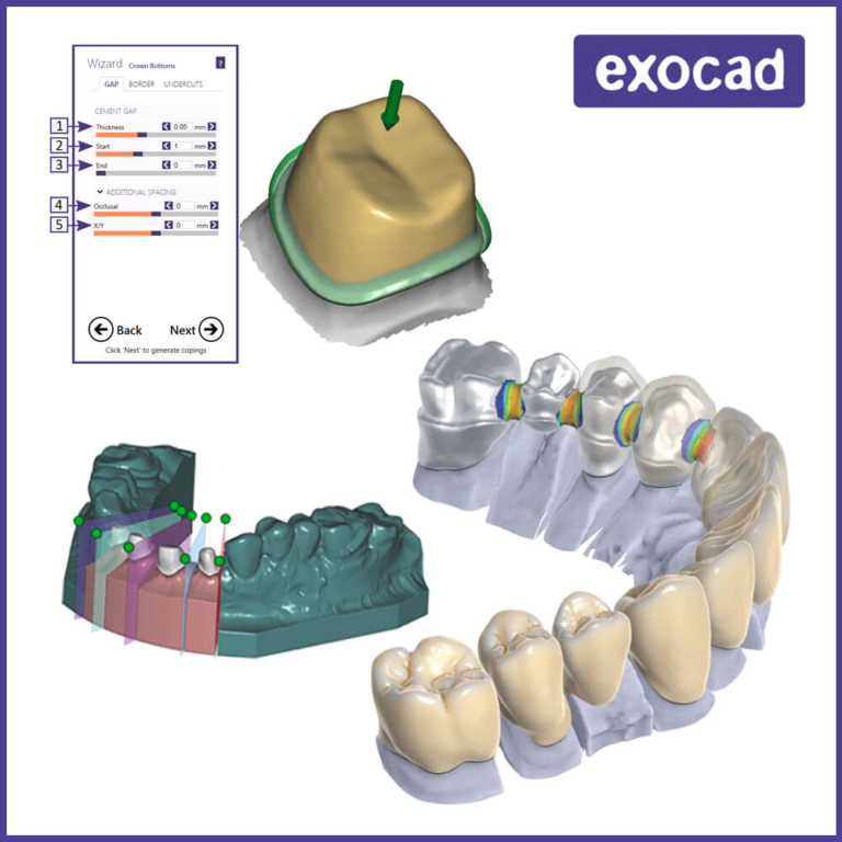 1C-Software CAD - exocad • La transformación digital para laboratorios ...