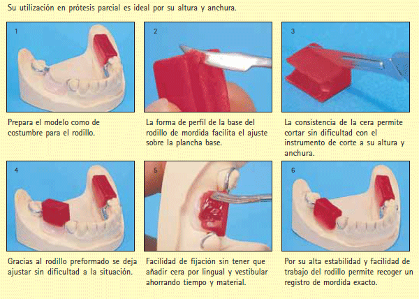 2M1 Ceras Pr tesis Total Para Laboratorio Bredent