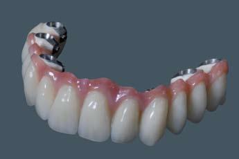 2M19 - PEEK Ceramico (BioHPP) y Discos Cad Cam de bredent